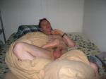 fat scrotum