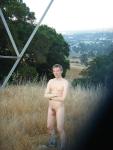 Naked outdoors - smile and bandaids
