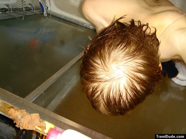 Photo flash makes it look bald.