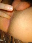 Buttocks