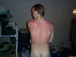 Redback
