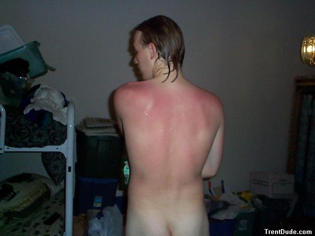 Redback