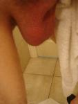 Scrotum being dried off by a towel