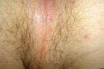 what is this a photo of, gross!