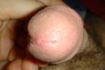  Closeups - tip of penis - high magnification