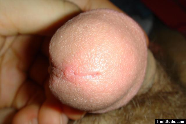  Closeups - tip of penis - high magnification