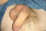 Closeups - flaccid penis underside - no scar