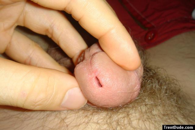 opening of penis hole