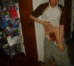 Hanging scrotum